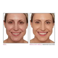 IT Cosmetics Your Skin But Better Foundation + Skinca Re 11 IT Cosmetics Your Skin But Better Foundation + Skinca Re -Éclat De Beauté 275754 it cosmetics your skin but better foundation skincare le fond de teint couvrance naturelle qui prend soin de votre peau medium neutral 31 autre2 1000x1000 1