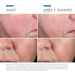 SkinCeuticals Phyto Corrective Brume Hydratante -Éclat De Beauté 278787 skinceuticals phyto corrective brume hydratante hautement concentree en acide hyaluronique apaise et reduit les rougeurs 50ml spray autre3 1000x1000 1